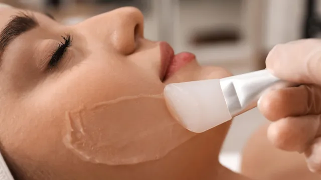 Chemical Peeling
